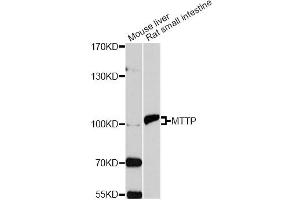 Western blot analysis of extracts of various cell lines, using MTTP antibody. (MTTP Antikörper)