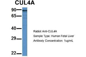 Host: Rabbit  Target Name: CUL4A  Sample Tissue: Human Fetal Liver  Antibody Dilution: 1. (Cullin 4A Antikörper  (Middle Region))
