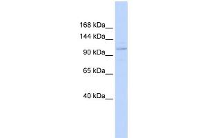 WB Suggested Anti-ST18 Antibody Titration:  0.
