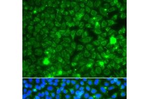 Immunofluorescence analysis of A549 cells using GBA3 Polyclonal Antibody (GBA3 Antikörper)