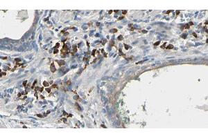ABIN6277241 at 1/100 staining Human prostate tissue by IHC-P. (HNMT Antikörper  (Internal Region))