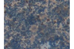Immunohistochemistry (IHC) image for anti-Fibroblast Growth Factor Receptor-Like 1 (FGFRL1) (AA 164-368) antibody (ABIN7439552)