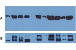Use of alpha Tubulin monoclonal antibody, clone TU-01  as a loading control (A) in an Western blotting experiment revealing the staining pattern of various cell lysates by a newly developed monoclonal antibody (B). (alpha Tubulin Antikörper)
