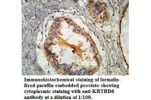 Image no. 1 for anti-Kelch Repeat and BTB (POZ) Domain Containing 8 (KBTBD8) antibody (ABIN1577436) (KBTBD8 Antikörper)