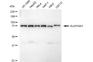 anti-Aldehyde Dehydrogenase 16 Family, Member A1 (ALDH16A1) antibody
