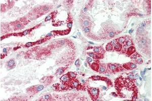 Immunohistochemistry (IHC) image for anti-NADH Dehydrogenase (Ubiquinone) Fe-S Protein 6, 13kDa (NADH-Coenzyme Q Reductase) (NDUFS6) (Internal Region) antibody (ABIN571094)