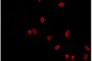 ABIN6269400 staining HeLa cells by IF/ICC. (HDAC6 Antikörper  (N-Term))