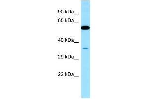 Western Blotting (WB) image for anti-Vacuolar Protein Sorting 33 Homolog A (VPS33A) (Middle Region) antibody (ABIN2501158)
