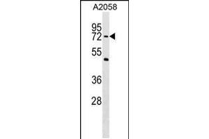Western blot analysis in A2058 cell line lysates (35ug/lane). (PHF19 Antikörper  (C-Term))