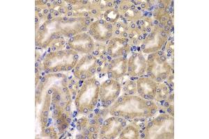 Immunohistochemistry of paraffin-embedded mouse kidney using C antibody (ABIN6127549, ABIN6137937, ABIN6137938 and ABIN6223226) at dilution of 1:100 (40x lens). (CARD10 Antikörper  (AA 863-1032))