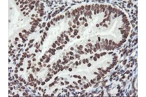 Image no. 3 for anti-F-Box Protein 21 (FBXO21) antibody (ABIN1498233) (FBXO21 Antikörper)
