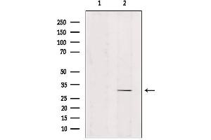 Western blot analysis of extracts from mouse brain, using ZNF498 Antibody.