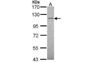 Retinoblastoma Binding Protein 8 Antikörper  (Center)