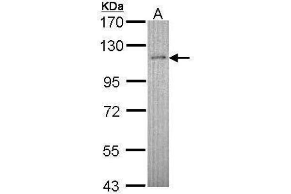 Retinoblastoma Binding Protein 8 Antikörper  (Center)