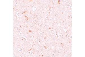 Immunohistochemical staining of human brain cells with SH3RF2 polyclonal antibody  at 10 ug/mL. (SH3RF2 Antikörper  (C-Term))