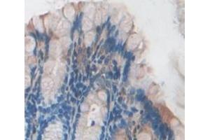 IHC-P analysis of Mouse Tissue, with DAB staining. (ITPA Antikörper  (AA 2-198))