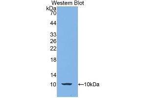 Detection of Recombinant CALY, Human using Polyclonal Antibody to Calcyon Neuron Specific Vesicular Protein (CALY) (CALY Antikörper  (AA 1-63))