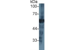 Detection of NEU in Mouse Pancreas lysate using Polyclonal Antibody to Neuraminidase (NEU) (NEU1 Antikörper  (AA 47-415))
