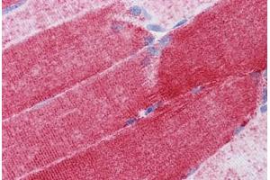 Human Skeletal muscle: Formalin-Fixed, Paraffin-Embedded (FFPE)