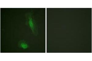 Immunofluorescence analysis of HeLa cells, using Akt (Ab-129) Antibody. (AKT1 Antikörper  (AA 95-144))