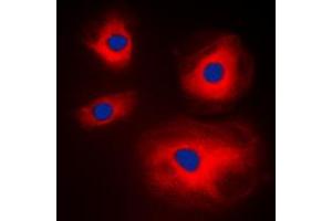 Immunofluorescent analysis of MRPL11 staining in A431 cells. (MRPL11 Antikörper  (Center))