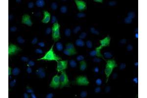 Anti-PFKP mouse monoclonal antibody (ABIN2455341) immunofluorescent staining of COS7 cells transiently transfected by pCMV6-ENTRY PFKP (RC200673). (PFKP Antikörper)