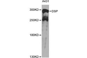 Western blot analysis of extracts of A431 cells, using DSP antibody (ABIN6291454) at 1:1000 dilution.
