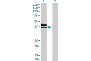 Lane 1: HS3ST1 transfected lysate ( 33. (HS3ST1 293T Cell Transient Overexpression Lysate(Denatured))