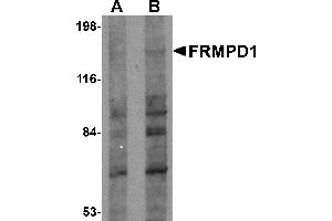Western Blotting (WB) image for anti-FERM and PDZ Domain Containing 1 (FRMPD1) (C-Term) antibody (ABIN1030403) (FRMPD1 Antikörper  (C-Term))