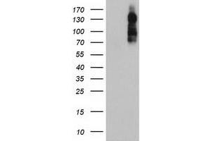 HEK293T cells were transfected with the pCMV6-ENTRY control (Left lane) or pCMV6-ENTRY ENPEP (Right lane) cDNA for 48 hrs and lysed. (ENPEP Antikörper)