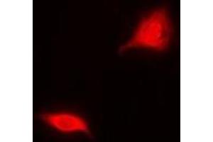 Immunofluorescent analysis of Aspartoacylase staining in MCF7 cells. (ASPA Antikörper)