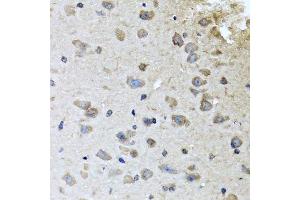 Immunohistochemistry of paraffin-embedded mouse brain using BRCA1 antibody. (BRCA1 Antikörper  (AA 120-220))