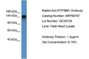 WB Suggested Anti-PITPNM1  Antibody Titration: 0. (PITPNM1 Antikörper  (N-Term))