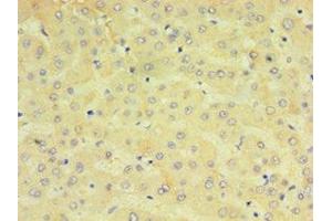 Immunohistochemistry of paraffin-embedded human liver tissue using ABIN7149253 at dilution of 1:100 (CYP2J2 Antikörper  (AA 328-502))