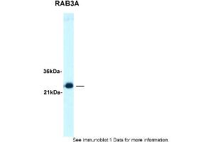 Sample Type: Human brainSecondary Antibody: TIgG product, 1. (RAB3A Antikörper  (C-Term))