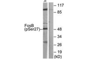 Western Blotting (WB) image for anti-FBJ Murine Osteosarcoma Viral Oncogene Homolog B (FOSB) (AA 12-61), (pSer27) antibody (ABIN1531599) (FOSB Antikörper  (pSer27))