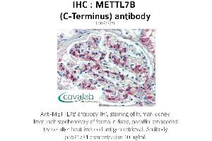 Image no. 2 for anti-Methyltransferase Like 7B (METTL7B) (C-Term) antibody (ABIN1736925) (METTL7B Antikörper  (C-Term))