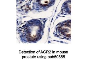Image no. 1 for anti-Anterior Gradient Homolog 2 (Xenopus Laevis) (AGR2) (AA 50-100) antibody (ABIN363664)