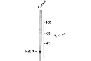 Image no. 1 for anti-RAB3A, Member RAS Oncogene Family (RAB3A) (N-Term) antibody (ABIN372708) (RAB3A Antikörper  (N-Term))