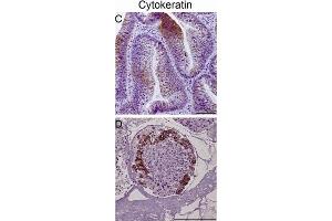 Immunohistochemistry (IHC) image for anti-Keratin 20 (KRT20) antibody (ABIN2856768)