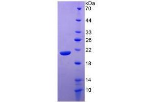 SDS-PAGE (SDS) image for Interleukin 20 (IL20) (AA 25-176) (Active) protein (His tag) (ABIN6239769)