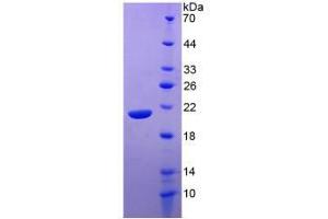 Figure. (IL-20 Protein (AA 25-176) (His tag))
