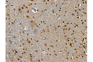 ABIN6260189 and ABIN6268682 at 1/100 staining Rat brain tissue by IHC-P.