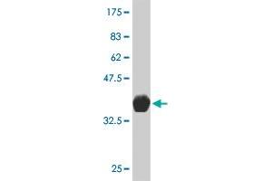 Western Blot detection against Immunogen (36. (SMARCB1 Antikörper  (AA 81-180))