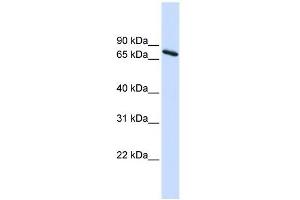 Ubiquilin 1 antibody used at 1 ug/ml to detect target protein. (Ubiquilin 1 Antikörper  (Middle Region))