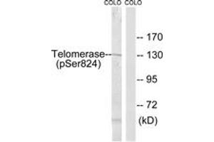 Western blot analysis of extracts from COLO205 cells, using Telomerase (Phospho-Ser824) Antibody. (TERT Antikörper  (pSer824))