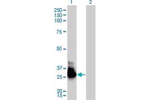 Western Blot analysis of GNA13 expression in transfected 293T cell line by GNA13 monoclonal antibody (M01), clone 6F6-B5. (GNA13 Antikörper  (AA 1-377))