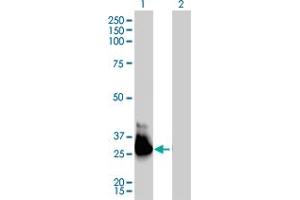 Western Blot analysis of GNA13 expression in transfected 293T cell line by GNA13 monoclonal antibody (M01), clone 6F6-B5.