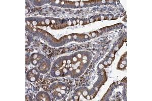 Immunohistochemical staining of human duodenum with NAT16 polyclonal antibody  shows cytoplasmic positivity in glandular cells. (NAT16 Antikörper)