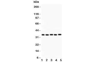 Western blot testing of HOXA11 antibody and Lane 1:  rat brain;  2: human placenta;  3: human HeLa;  4: (h) HT1080;  5: mouse HEPA lysate. (Homeobox A11 Antikörper  (AA 74-245))